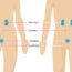 Treatment and prevention of urinary tract infections