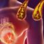 How to clean out plaque in arteries - 3 ingredients mixture