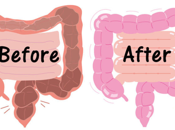 Cleanse your colon and lose 20 pounds in 3 weeks