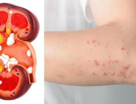 If Your Kidney Is in Danger, the Body Will Give You These 8 Signs!