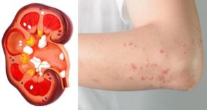 If Your Kidney Is in Danger, the Body Will Give You These 8 Signs!