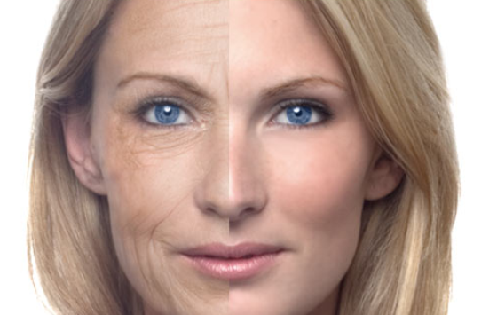 How to Reduce Wrinkles and Look Younger