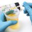 What the color of your urine and frequent urination can tell you about your health?