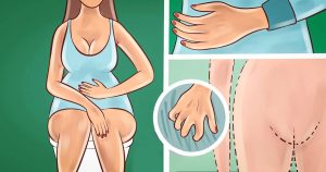 Every single way to use coconut oil to reverse yeast infection and any feminine hygiene issue