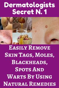 A great number of the human population has some skin issues and problems that occur due to aging, bad diet and so on. Most of these are usually moles, skin tags, blackheads and some others. There are many ways how to treat most of them.