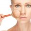 HOW TO EASILY REMOVE SKIN TAGS, MOLES, BLACKHEADS, SPOTS AND WARTS BY USING NATURAL REMEDIES