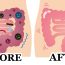 How Apple, Ginger And Lemon Makes the Most Powerful Colon Cleanser, It’ll Flush Pounds Of Toxins From Your Body!