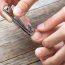 Treat Your Ingrown Toenail With These 6 Natural & Homemade Remedies