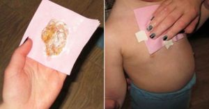 Ginger Wraps – Treats Bad Cough And Removes Mucus From The Lungs in One Night!